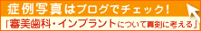 審美歯科・インプラントブログ