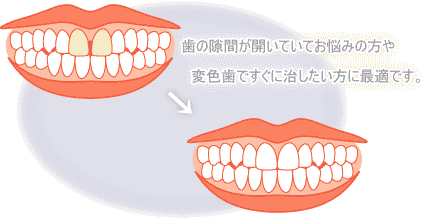 治療前後イメージ